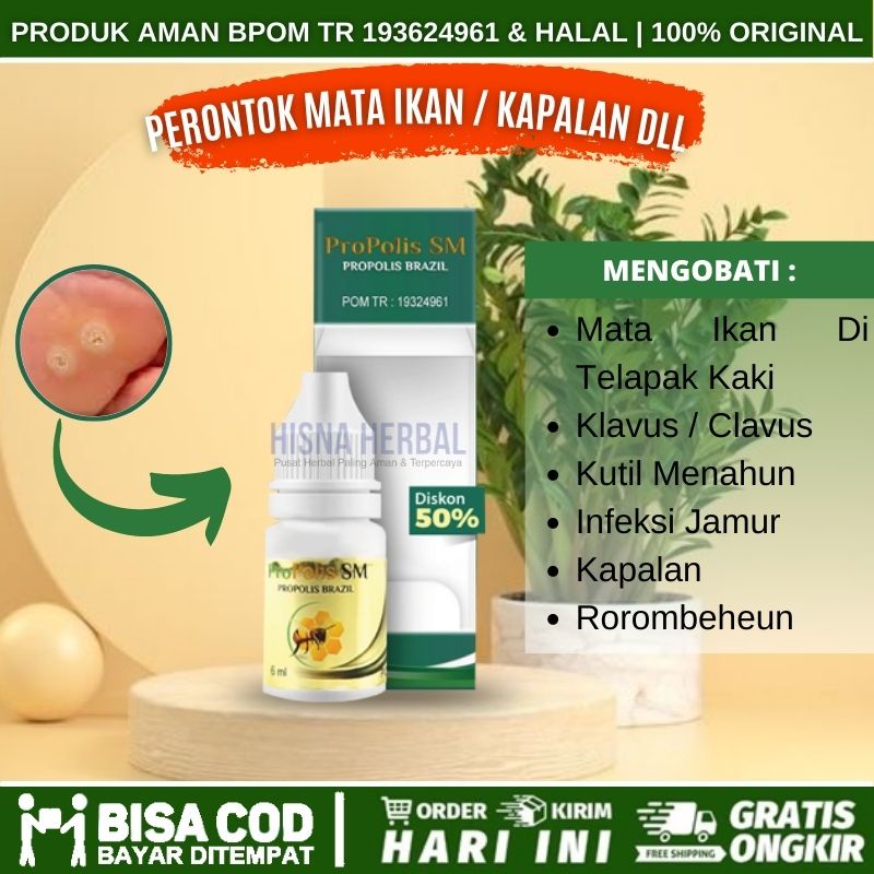 OBAT MATA IKAN DI TELAPAK KAKI TANGAN, PERONTOK KUTIL, PENCOPOT MATA IKAN SAMPAI AKAR, MENGHILANGKAN