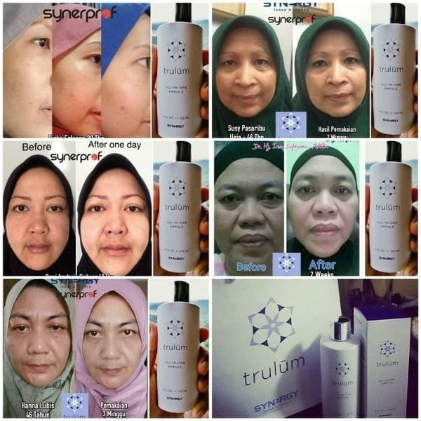 HOT - Trulum 5ml 15ml 120ml Perawatan Kulit Wajah Keriput