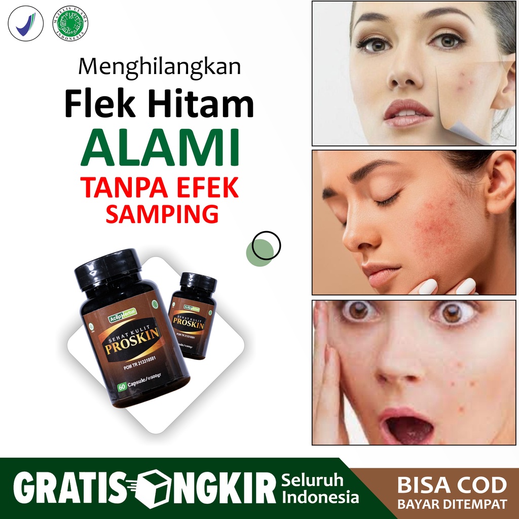 PROSKIN Penghilang Flek Hitam di Wajah Membandel Herbal Menghilangkan Plek Hitam di Muka Bekas Jeraw