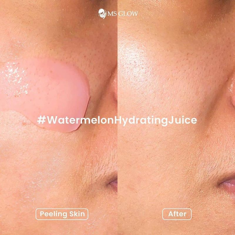 Watermelon hidrating || MS GLOW