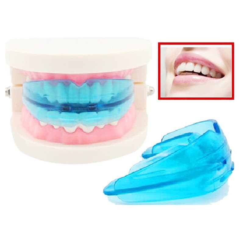 [CEV] Alat Perapi Perata Gigi Orthodontic Retainer Teeth Trainer Alignment