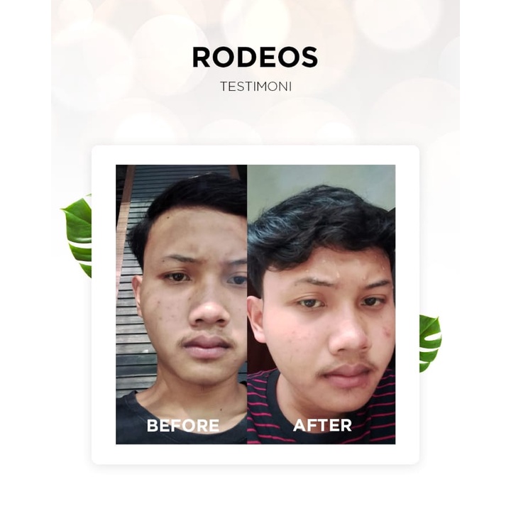 Rodeos Day Night Cream Krim Siang &amp; Malam Skincare Pria Pemutih Pencerah Penghilang Jerawat Wajah Pria BPOM SM6