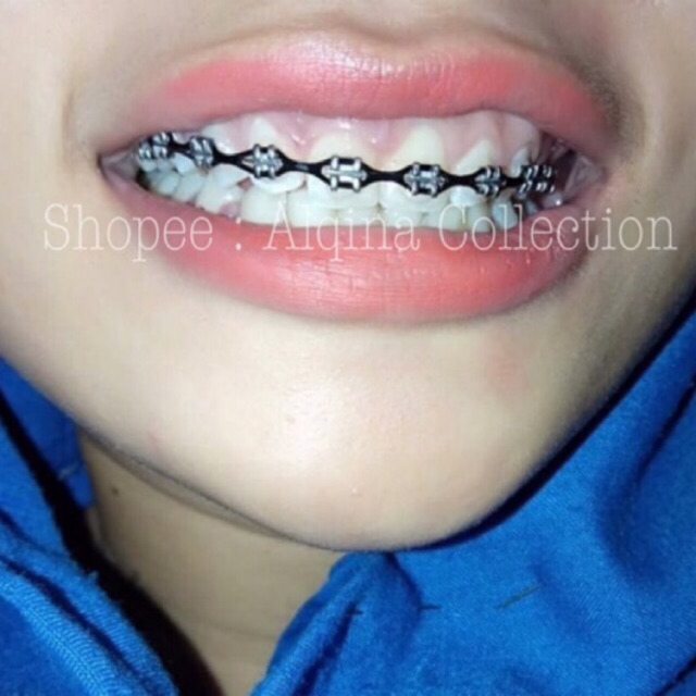 PAKET HEMAT Behel Atas Power Chain