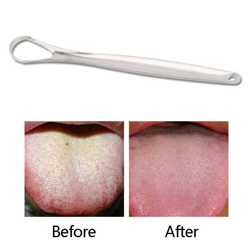 ~ PIYOSHI08 ~ Alat Sikat Pembersih Lidah Bahan Stainless Steel Reusable Tongue Scraper AK10