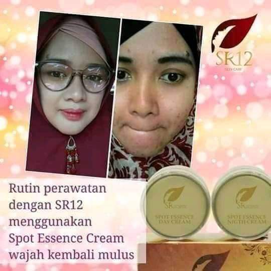 SPOT ESSENCE CREAM SR12 / KRIM SIANG MALAM / FLEK