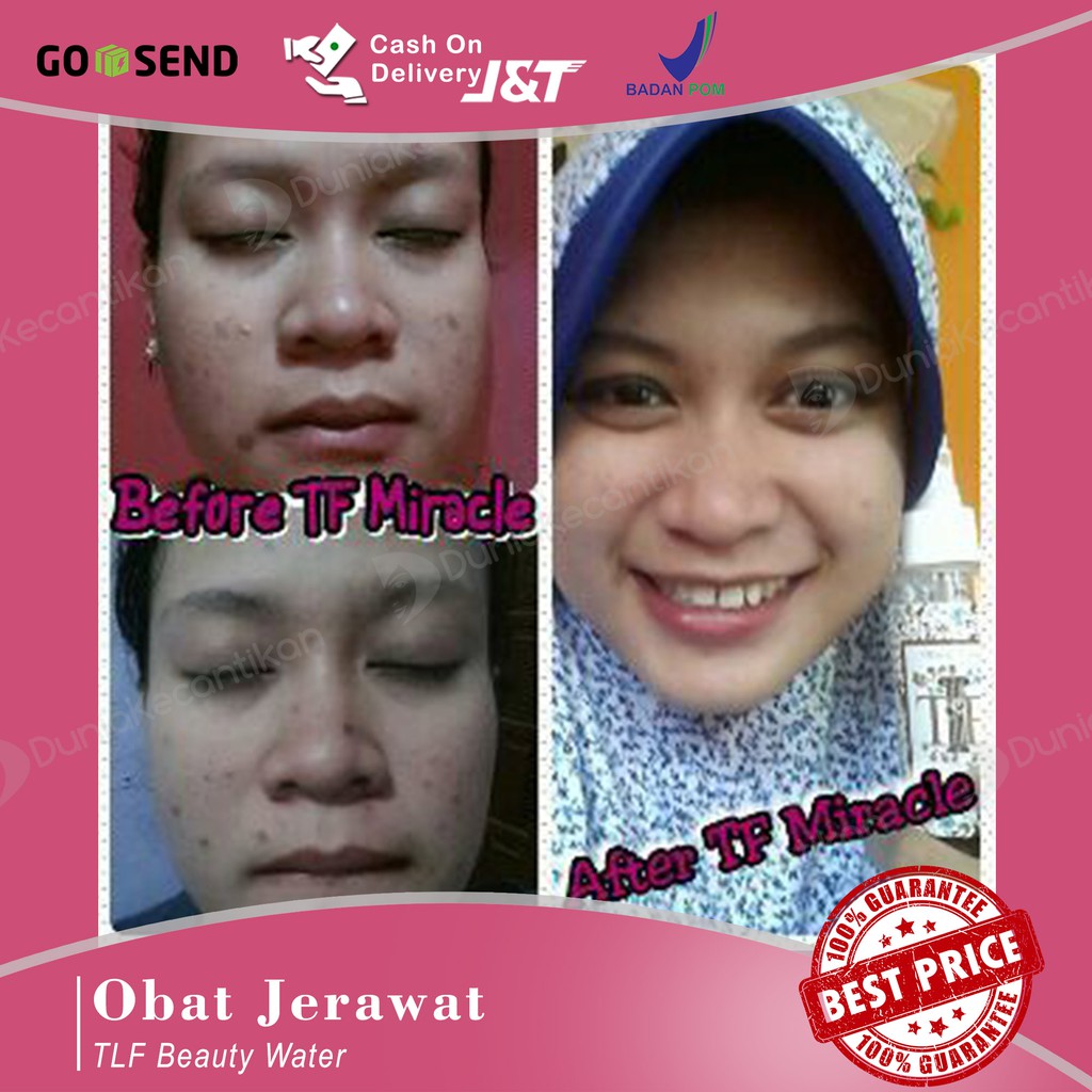 Obat Jerawat Ampuh Cepat Kering | Cleanser Toner - DKMALL TLF Beauty Water 100ml