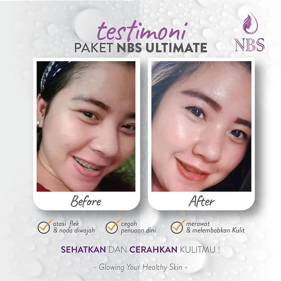 NBS Skincare Paket Ultimate Serum Cream Wajah Glowing BPOM Noni Beauty Skin