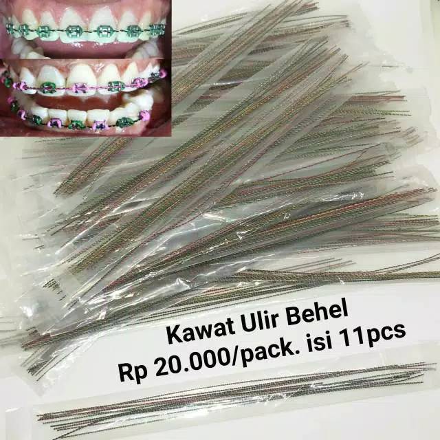 Kawat Ulir Per Pack / Kawat Ulir Behel