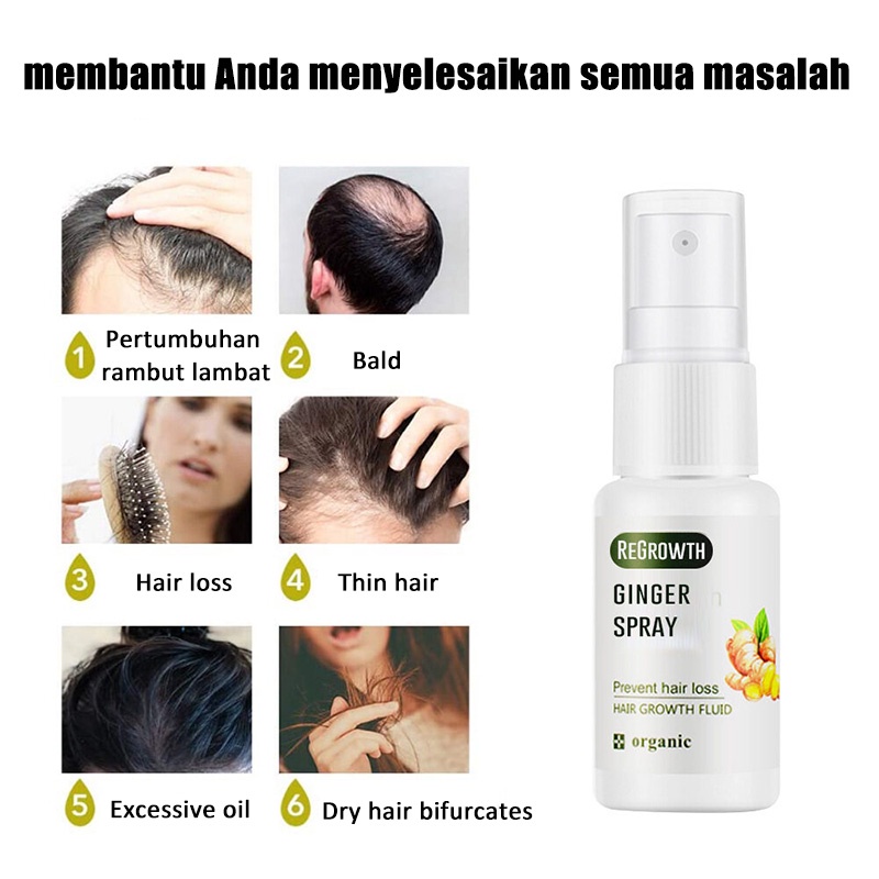 penumbuh rambut  penumbuh rambut botak serum penumbuh rambut 30g serum rambut rontok Penumbuh Rambut Cepat Anti Rontok Mengatasi Botak