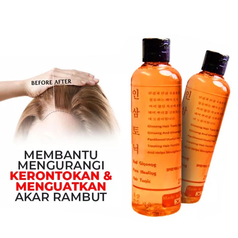 Beauty Jaya - Red Ginseng Hair Tonic Mengatasi Kebotakan &amp; Rambut Rontok Asli 100%