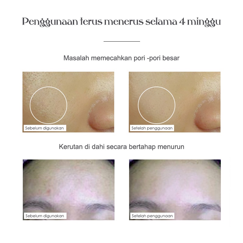 ⭐100% ORI⭐Newest 2022 Dr.Pen A1 A10 Wireless Electric Nano-Needle DERMAPEN A1-W MTS Alat BB Glow Pulihkan Gloss Elastis Wajah Dr.Pen A1 Cordless
