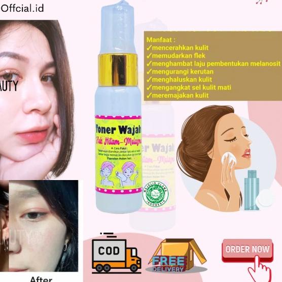 ✸ NBC Skincare - Toner Flek Membandel Tebal ➼