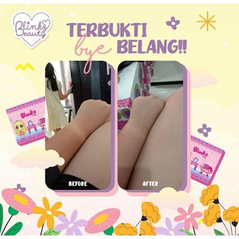 BLINKZ SOAP SABUN PEMUTIH BADAN BPOM /SABUN WHITENING BLINKZ