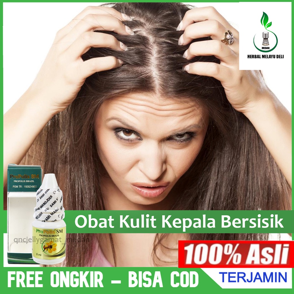 Obat Kulit Kepala Bersisik Berketombe Dermatitis Seboroik Gangguan kulit Kepala Herbal Propolis SM