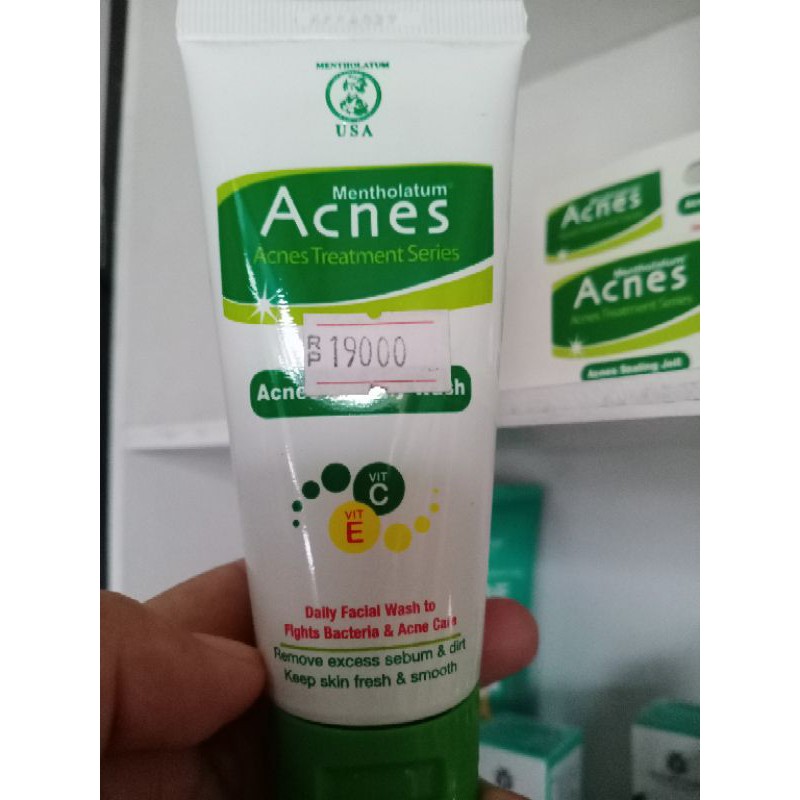 facial wash acnes