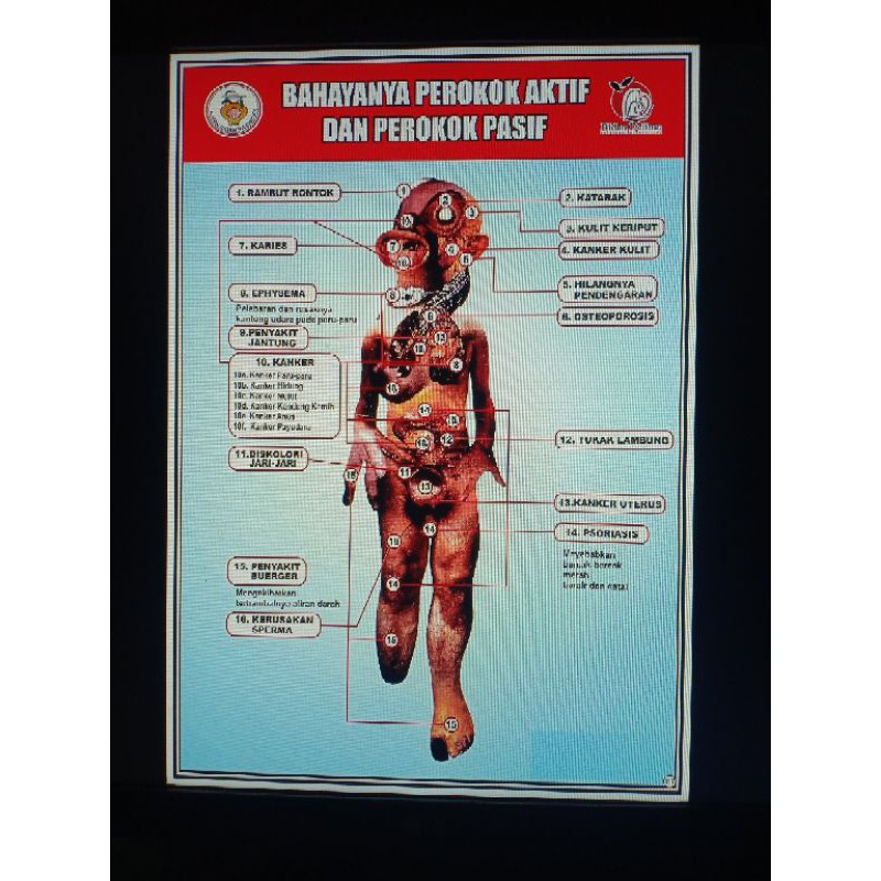 

POSTER BAHAYA PEROKOK AKTIF DAN PEROKOK PASIF (117)