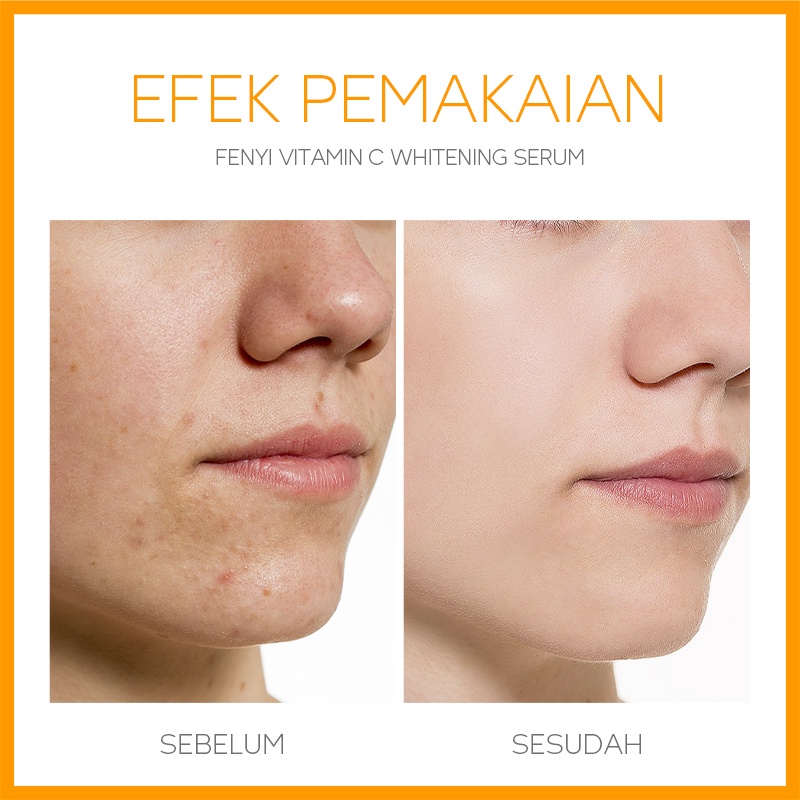 BPOM Fenyi Vitamin C Serum Mencerahkan Memudarkan Bintik Hitam Bekas Jerawat Anti Oksidan 17ml