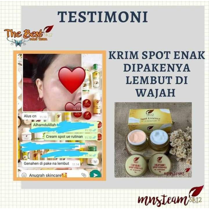 SPOT ESSENCE CREAM SR12 / KRIM SIANG MALAM / FLEK