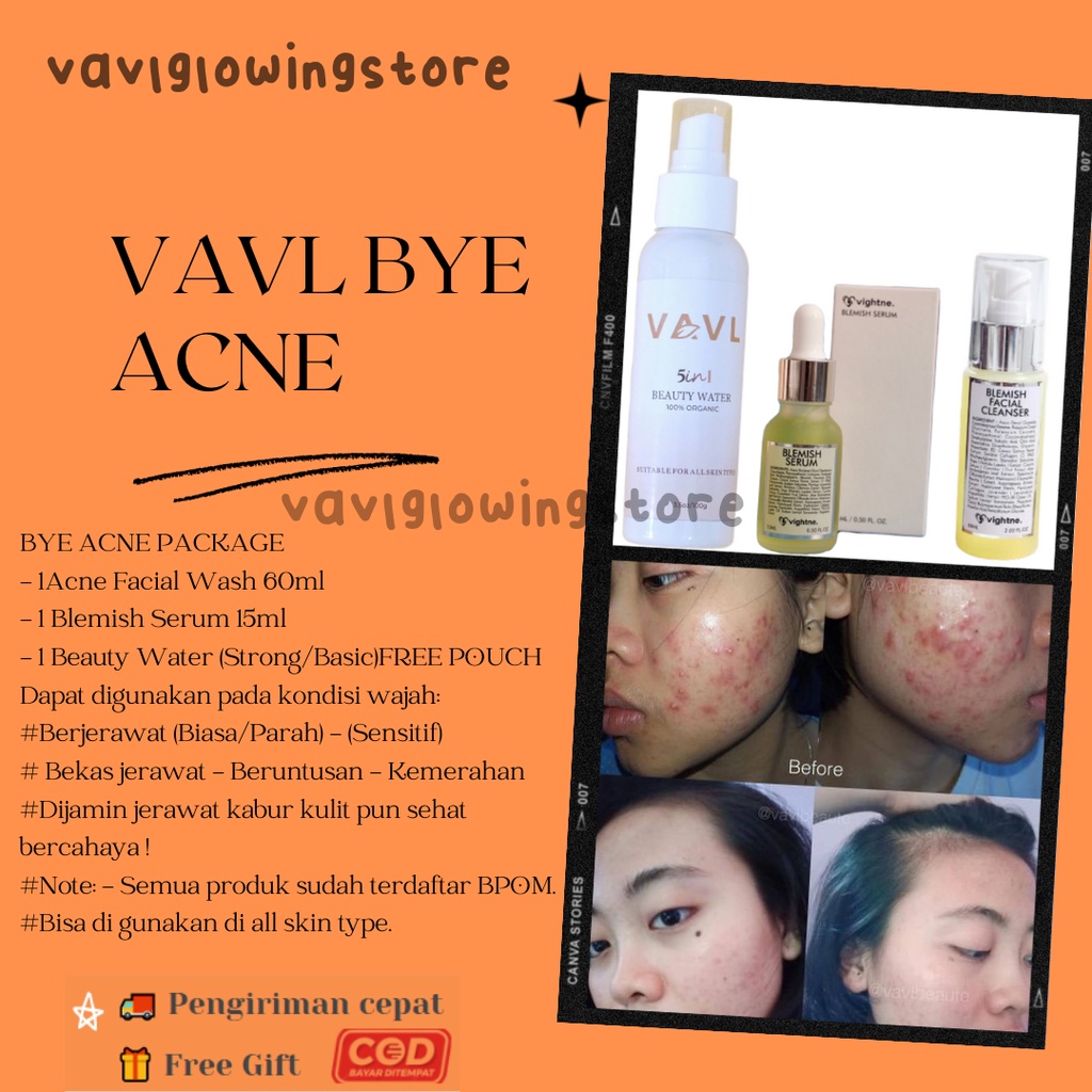 Paket Acne Package Vavl Beaute by Vivalentine free Pouch-7