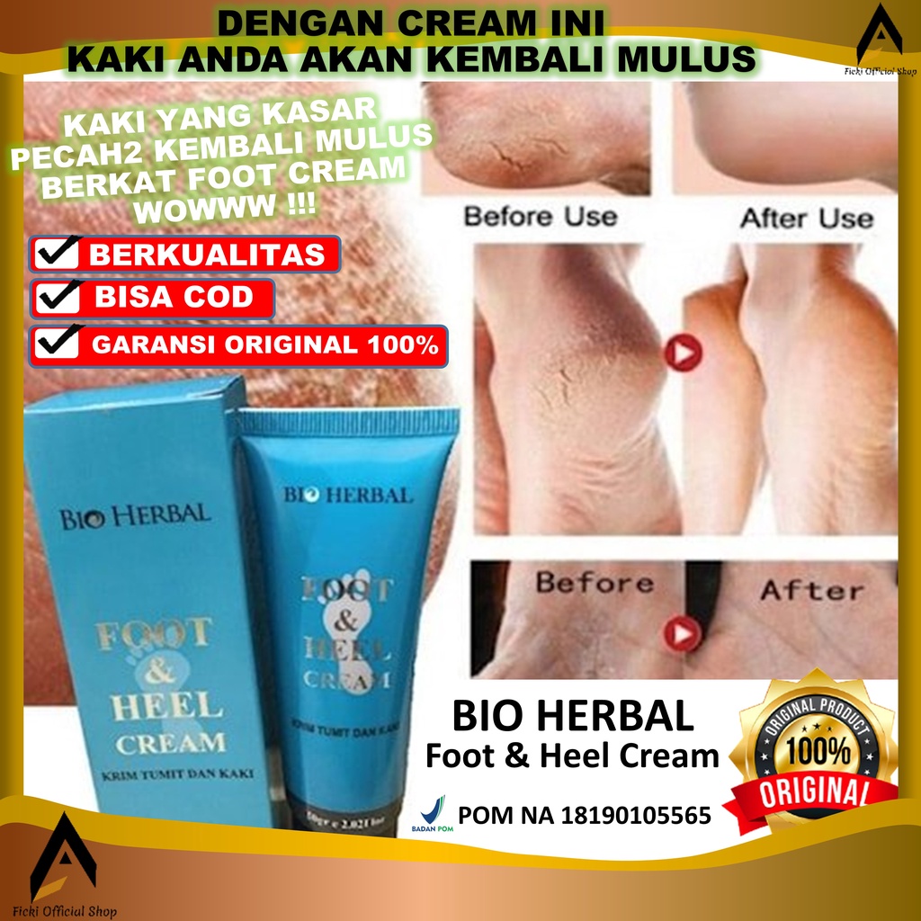 TERAMPUH!! Foot Cream Obat Kaki Pecah Dan Kering Obat Kaki Pecah2 Penghalus Tumit Kaki Ampuh