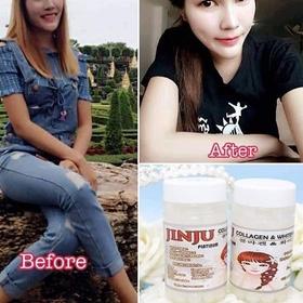 Special SUPLEMEN KECANTIKAN PEMUTIH PENCERAH KULIT JINJU COLLAGEN KOREA GLOW PERAWATAN KULIT PUTIH C