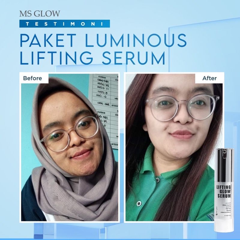 (Original 100%) Ms Glow Serum Lifting / Lifting Serum Ms Glow 15ml