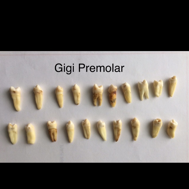 Gigi asli manusia posterior gigi premolar (gigi posterior premolar) utk praktikum