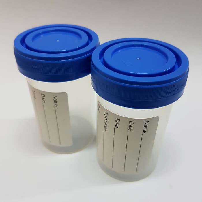 URINE CONTAINER 60ML