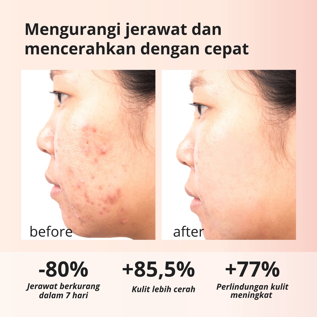 Lauralee Salmon DNA Sabun Wajah & Tubuh Pemutih 2in1 1 Box isi 2pcs Bright & Acne-7