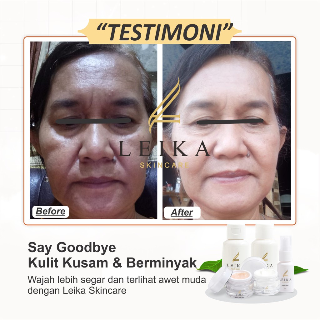 Leika Skincare Paket 5 in 1-4