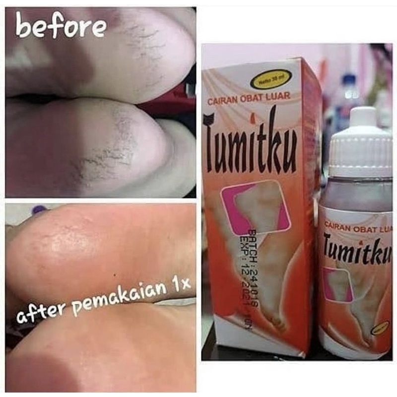 Tumitku Lotion Untuk Kaki Pecah Pecah Dan Menghaluskan Tumit 100% Original Obat Mujarab Aman TERBARU Original