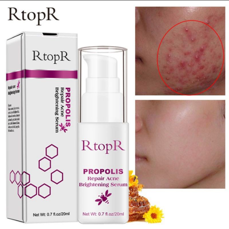 rtopr propolis repair acne brightening serum jerawat memudarkan noda hitam bekas jerawat