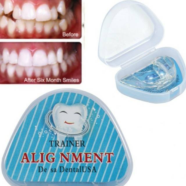 Perapih gigi /teeth trainer