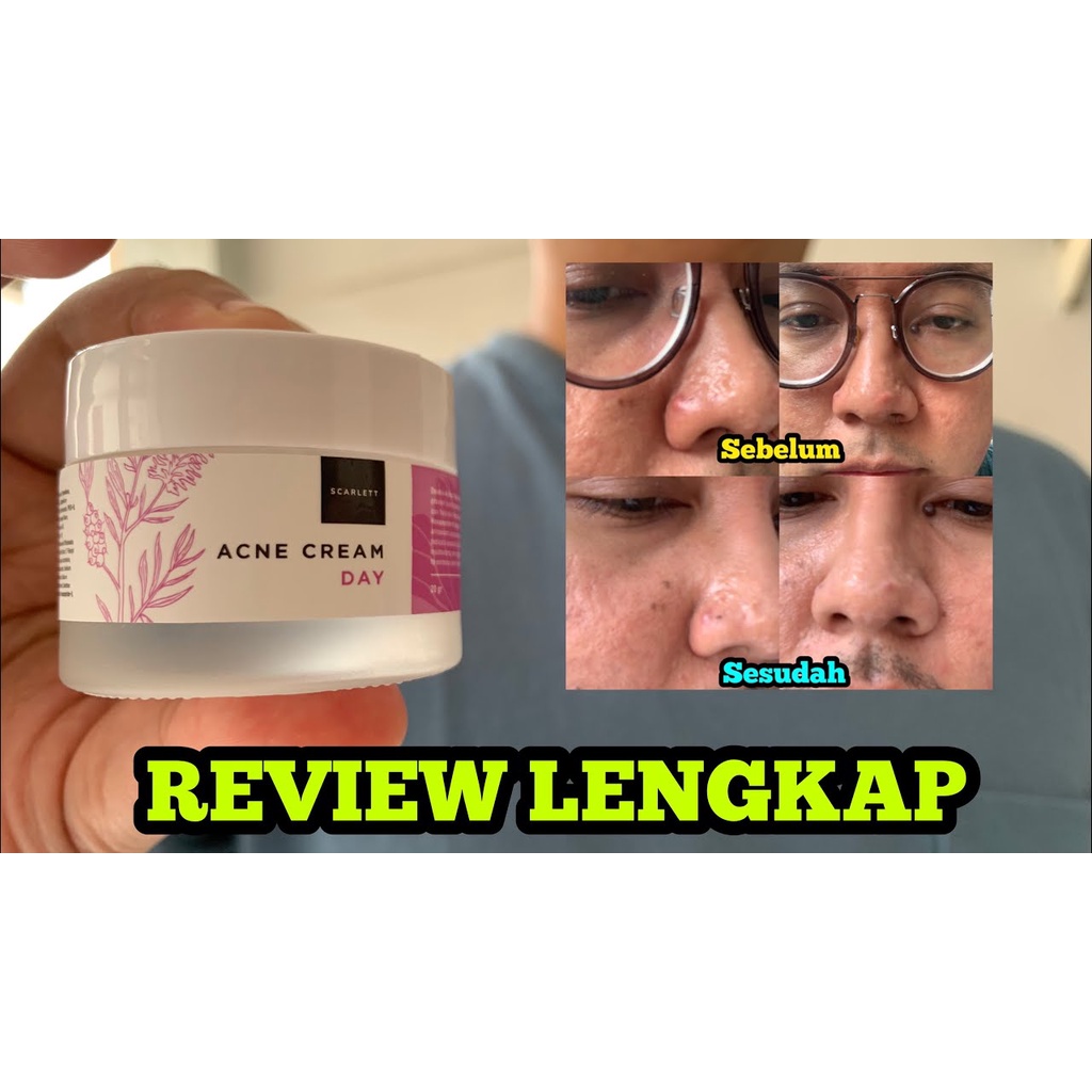 [ORI] Scarlett Whitening Acne Cream Day AMPUH Meredakan Peradangan Jerawat dalam 2 Minggu - BPOM