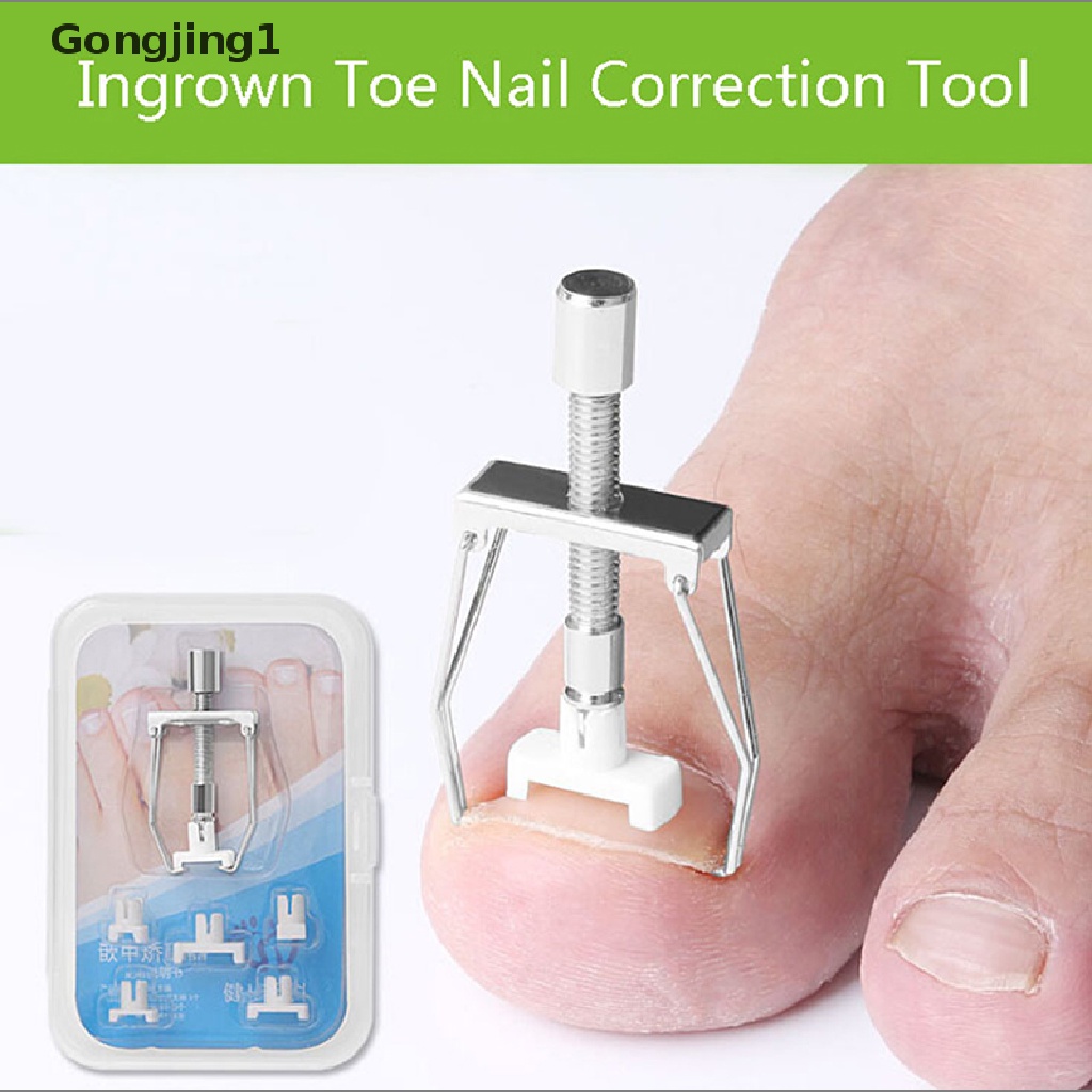 Gongjing1 Gunting Kuku Kaki Tumbuh Ke Dalam Untuk Pedicure