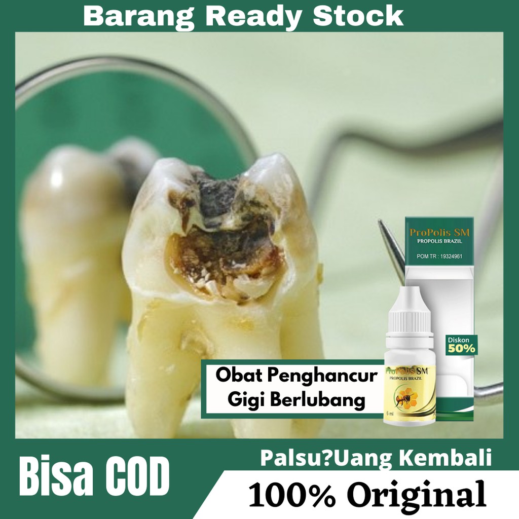 Obat Penghancur Gigi Berlubang , Gigi Ngilu , Gigi Berlubang Hitam | PROPOLIS SM 100% ASLI