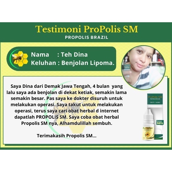 Obat Tetes/Oles Kista Tumor Benjolan Di Ketiak Payudara Tangan/Lengan Herbal Propolis SM Aman Untuk Anak Dan Dewasa