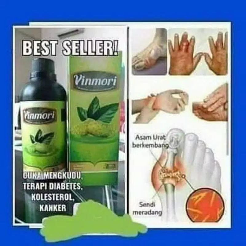 

Best Seller VINMORI mengatasi Diabetes