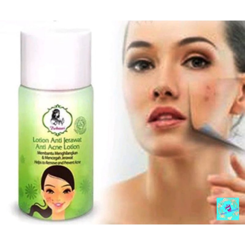 ♡Happyshoping88♡Purbasari Lotion Anti Jerawat - Obat Jerawat-7