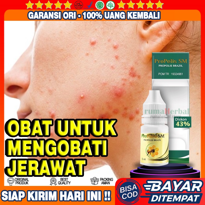 Obat Untuk Jerawat, Penghilang Bekas Jerawat Pria dan Wanita,Penghilang Komedo, Bopeng, Jerawat