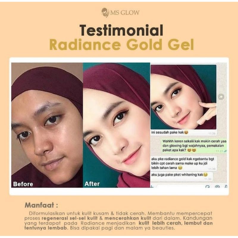Radiance Gold Gel Ms Glow Original JEL Perawatan Wajah glowing