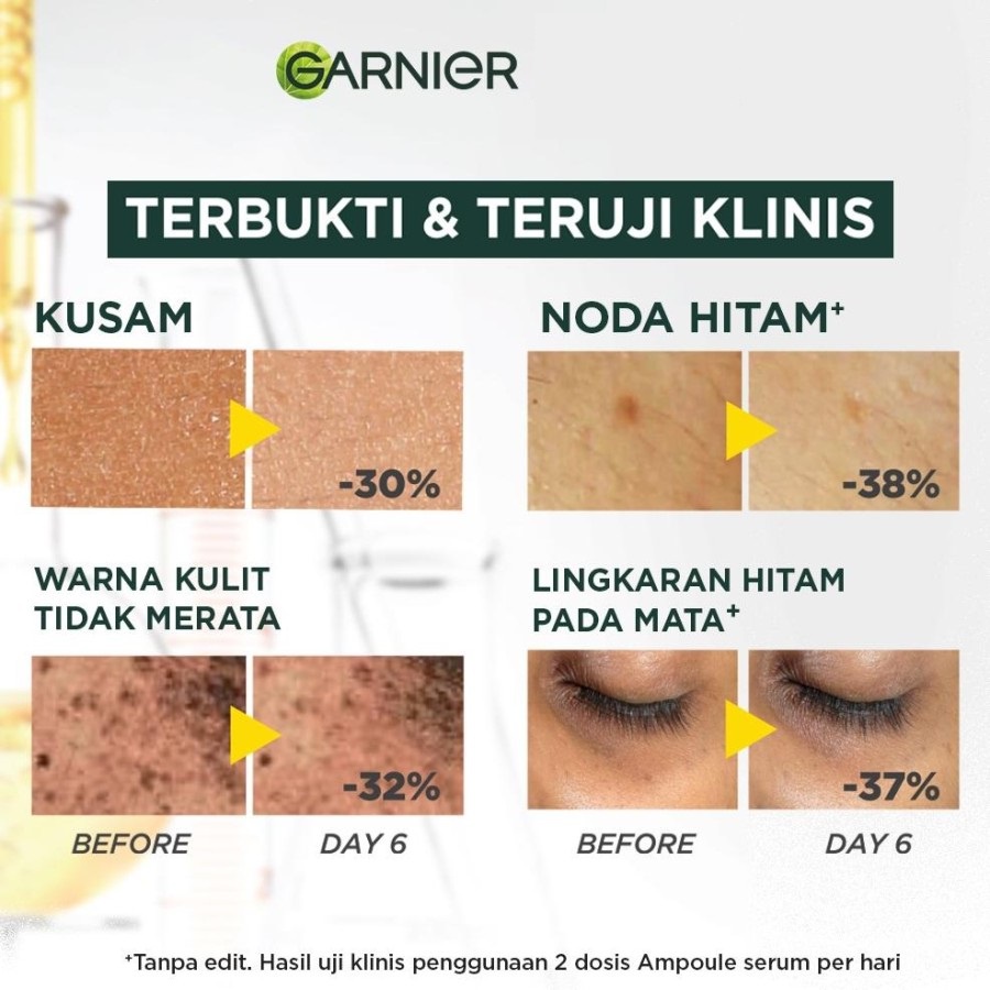 ★ BB ★  Garnier Bright Complete Ampoule Vitamin C Hiperpigmentasi Serum - Serum Wajah - Satuan