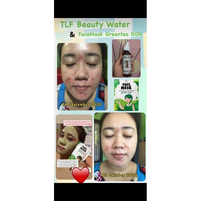 TLF BEAUTY WATER / TLF BEAUTY/ OBAT JERAWAT(FREE PARFUM ROLL ON JIKA TIDAK PROMO)