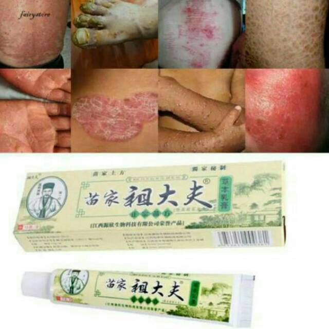 Zudaifu Salep Obat Gatal Selangkangan Eksim Jamur Psoriasis Ruam Original Import