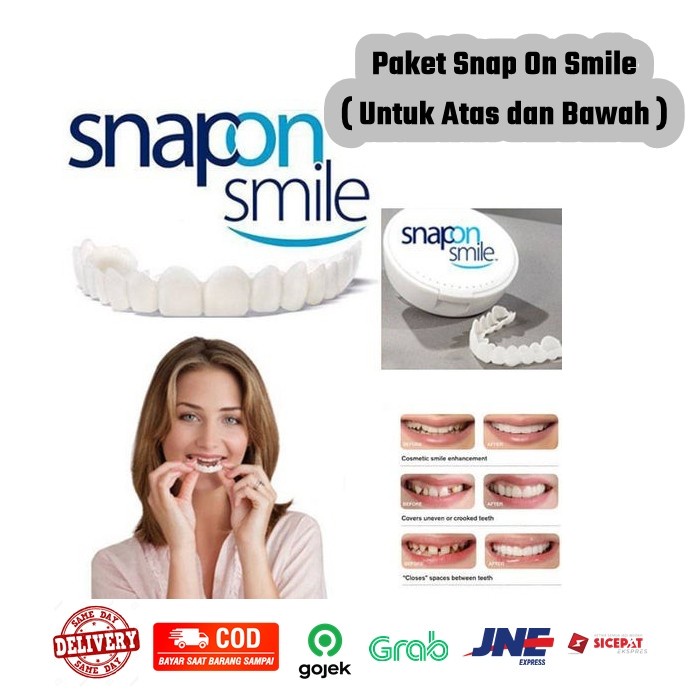 1 Set Gigi Palsu Instan Atas Bawah Penutup Ompong Lepas Pasang Snap on Smile Original