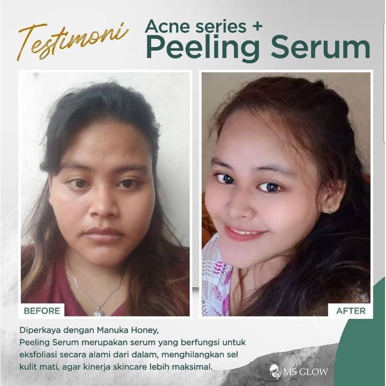 PEELING SERUM 10 ML MS GLOW BARKODE BPOM.