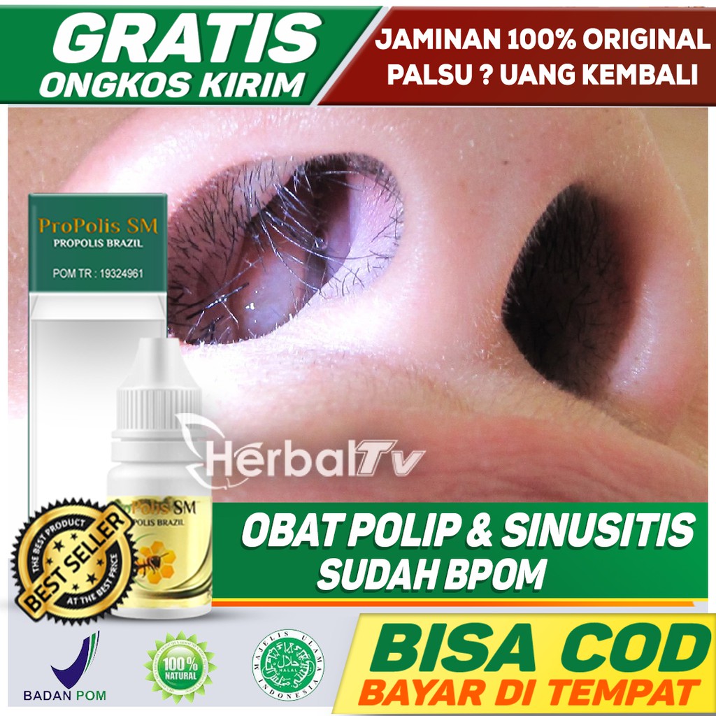 Obat Tetes Polip Hidung, Sinusitis, Hidung Kesumbat, Hidung Mampet Menahun Herbal BPOM