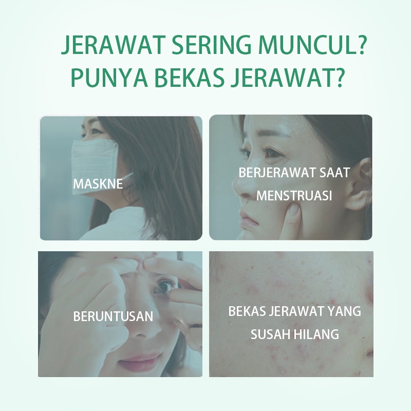 BioAqua Bio Aqua Acne Serum jerawat dan bekas jerawat Essence Face Serum Wajah Acne