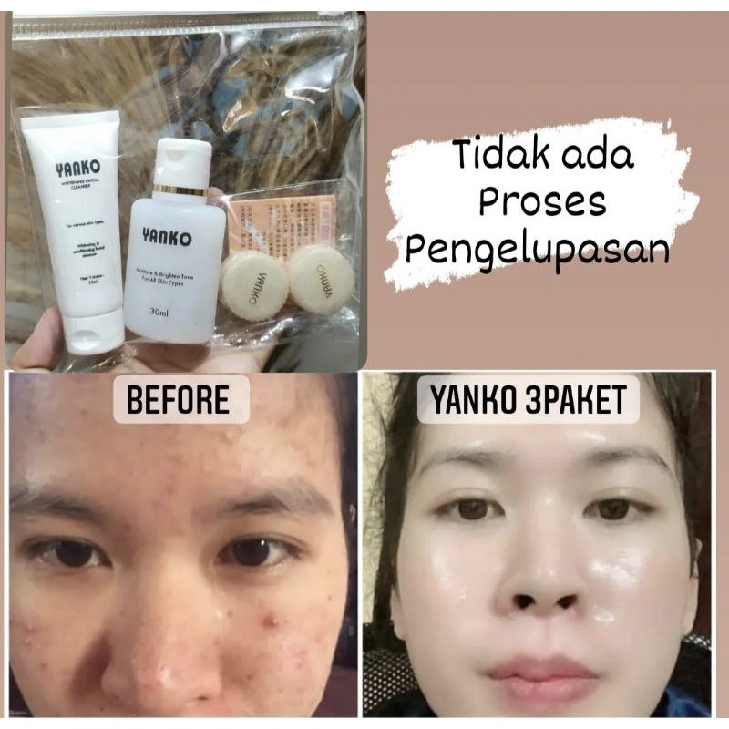 YANKO PAKET BASIC 4IN1