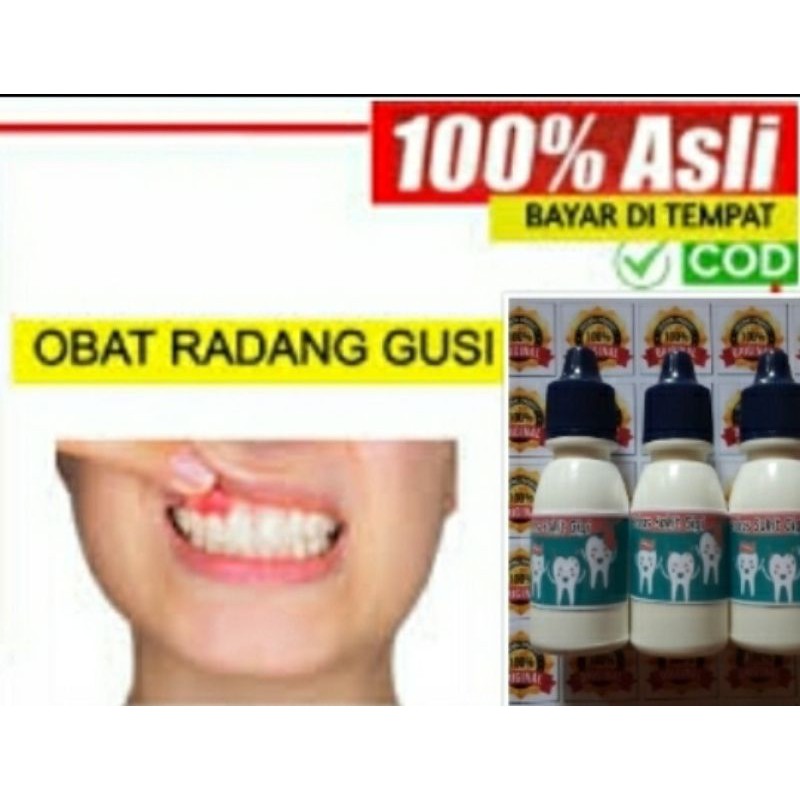 penghilang sakit gigi dan sakit gusi bengkak